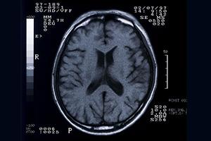 釧路の歯医者で口元を美しくできる