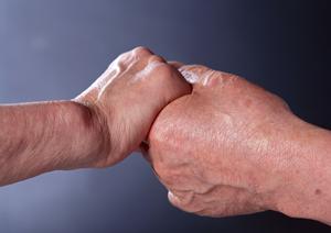 料金がわかりやすい札幌のインプラント