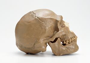 大和市の歯医者でマウスピース矯正